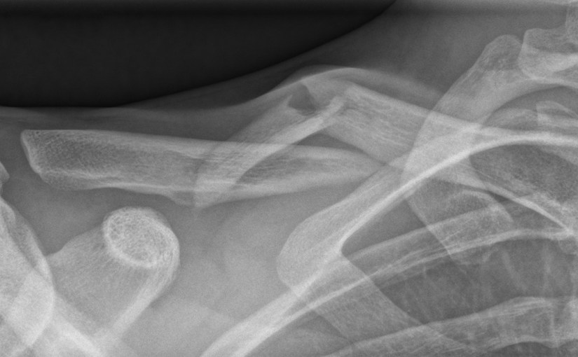 If the pot’s cracked, you might as well shatter&nbsp;it